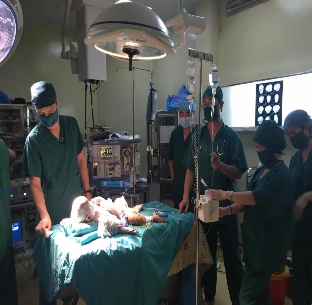 phẫu thuật dị dạng hộp sọ cho bé L