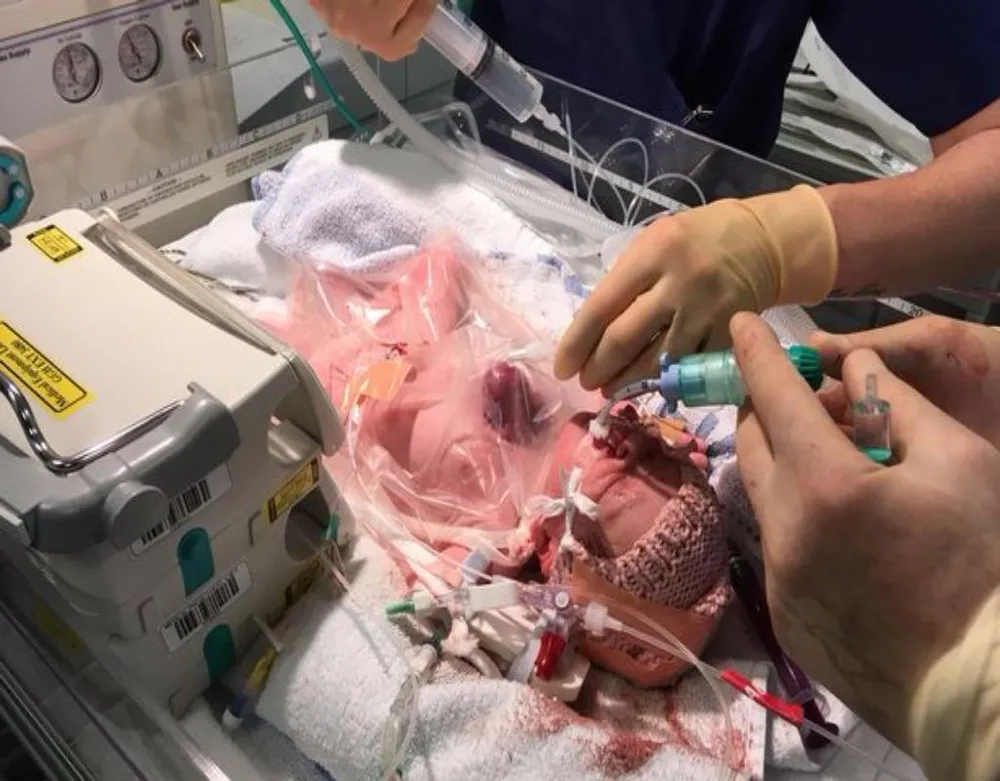 Cô bé Vanellope Wilkin đã giành lại được sự sống một cách thần kỳ