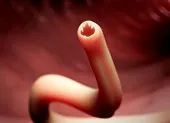 Lạ kỳ bé gái dị ứng với mồ hôi của chính mình ảnh 3 Ngồi trên bãi biển, bị giun chui từ mông lên phổi