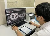 Những ai cần đi khám xơ phổi sau khi khỏi COVID-19? ảnh 2 Khỏi COVID-19 vẫn ho nhiều có phải phổi bị tổn thương?