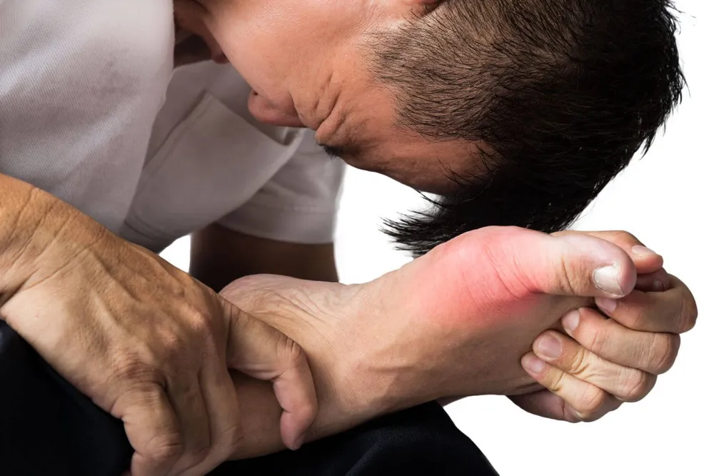 Cơn đau do gút cấp thường xảy ra dữ dội ở các khớp vào ban đêm. Hình minh họa Cơn đau do gút cấp thường xảy ra dữ dội ở các khớp