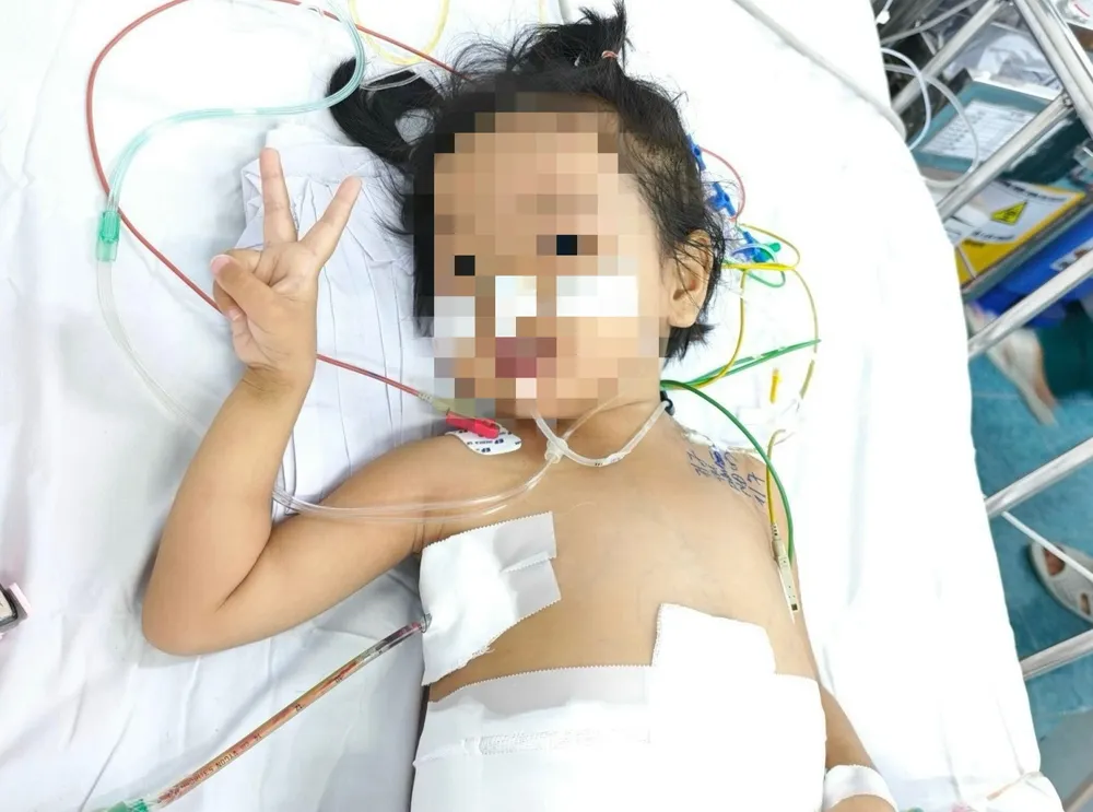 Bệnh nhi hơn 3 tuổi mắc hội chứng hiếm gặp được ghép gan thành công tại Bệnh viện Nhi đồng 2. Ảnh: BVCC ca ghép gan đặc biệt tại Bệnh viện Nhi đồng 2