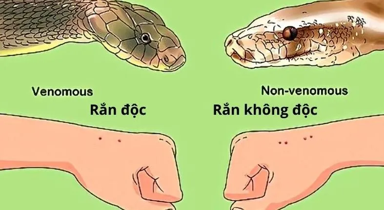 Cách phân biệt rắn độc và rắn không độc qua vết cắn. (Ảnh: Internet) bão số 3 nhiều người bị rắn cắn