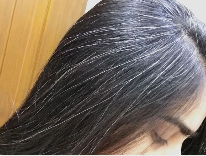 Tóc bạc sớm do nhiều nguyên nhân trong đó có di truyền