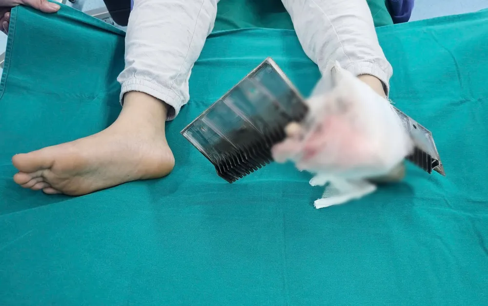 Bé trai bị kẹp chân vào thang cuốn