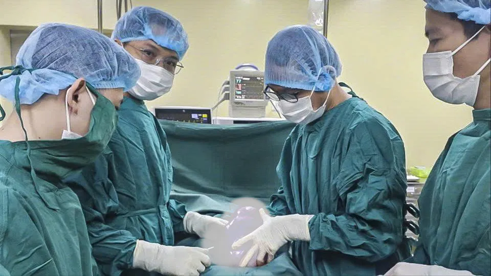 Khối u buồng trứng kích thước lớn được lấy ra từ bụng bệnh nhân