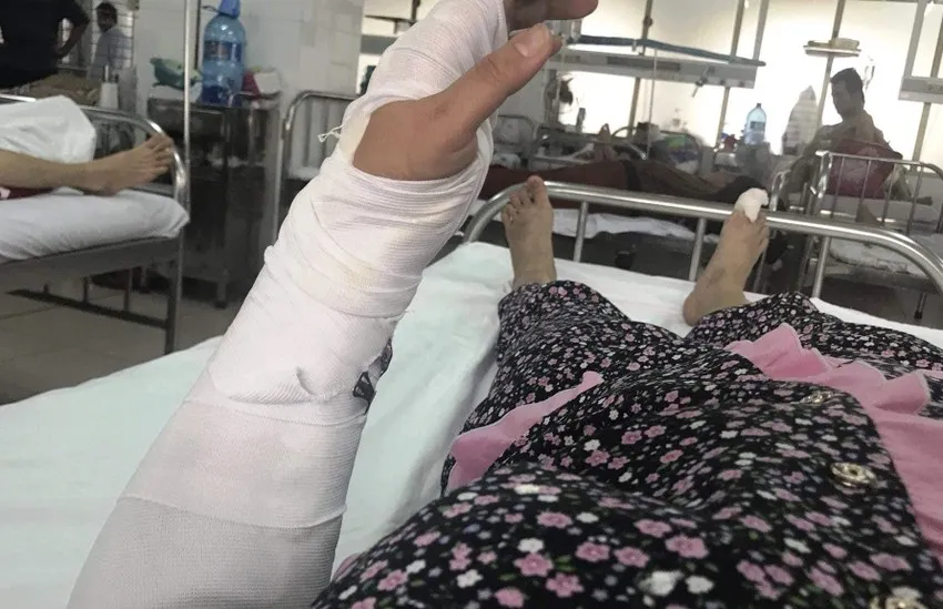Người vợ bị gãy tay và nhiều vết thương khác. Ảnh: Chị P cung cấp Người vợ bị gãy tay và nhiều vết thương khác. Ảnh: Chị P cung cấp