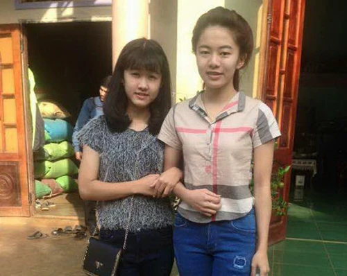 Bệnh viện nhận trách nhiệm vì nữ sinh lớp 10 bị cưa chân ảnh 2 Bệnh viện nhận trách nhiệm vì nữ sinh lớp 10 bị cưa chân ảnh 2