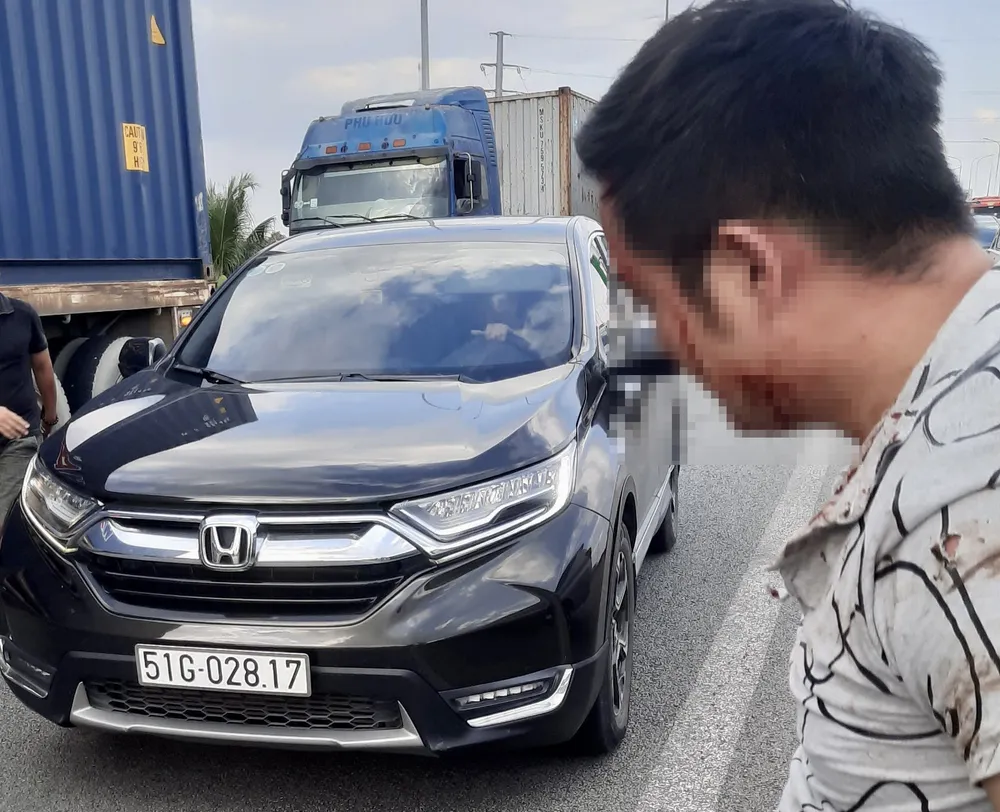 Anh Tú bị đa chấn thương sau vụ nhóm người hành hung