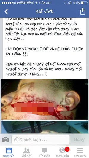 Nam sinh bị rạch mặt dã man, lên Facebook kêu gọi cảnh giác ảnh 1 Lời kêu gọi cảnh giác của B. trên trang cá nhân của mình đang nhận được hànhg nghìn lượt chia sẻ.