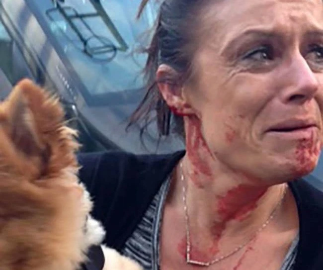 Một phụ nữ phải đổ máu để bảo vệ tính mạng chú chó cưng ảnh 1