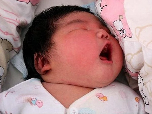 Ngỡ ngàng với bé trai mới sinh nặng bằng trẻ 3 tháng tuổi ảnh 1