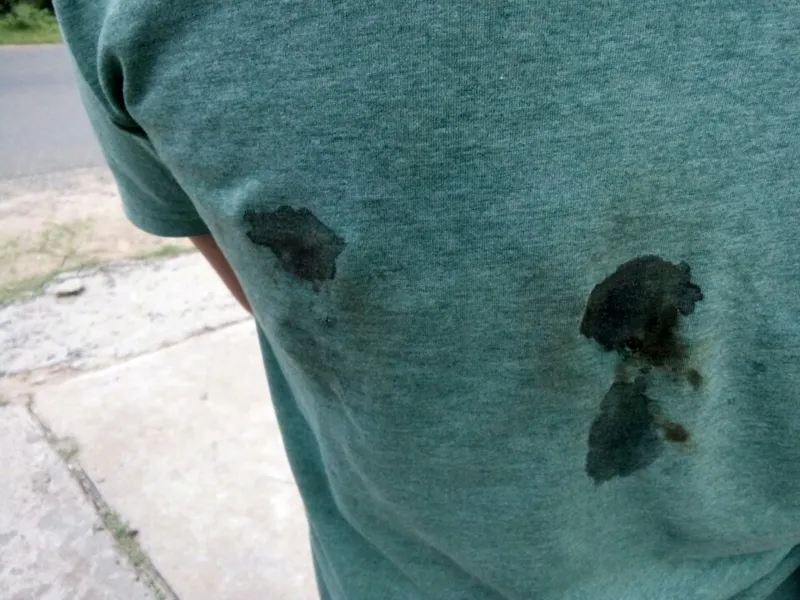 Một công dân phản ánh bị thiếu tá công an bắn vào lưng ảnh 2