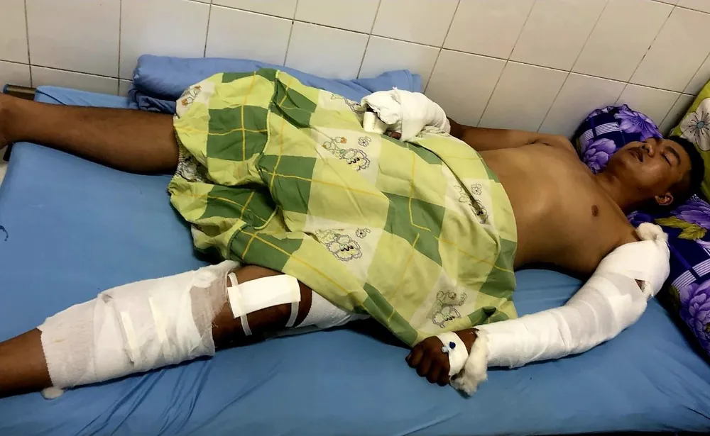 Phạm Hoàng Hải Dương bị thương nặng sau khi bị nhóm côn đồ truy sát Ảnh: VÕ TÙNG