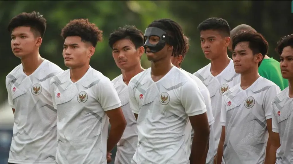 Tiền đạo Ronaldo của U-20 Indonesia bị sụp sống mũi, phải mang mặt nạ. Ảnh: BOLA