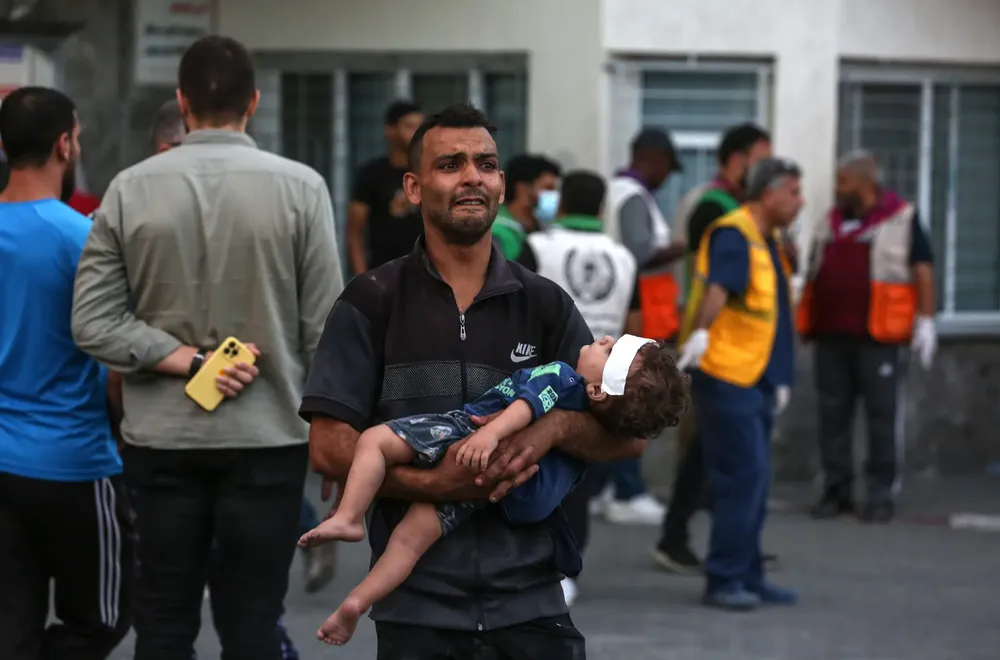 Người đàn ông bế đứa trẻ bị thương sau cuộc pháo kích tại BV Al Shifa ở Dải Gaza. Ảnh: THE NEW YORK TIMES ẢNH 2_CON TIN.png