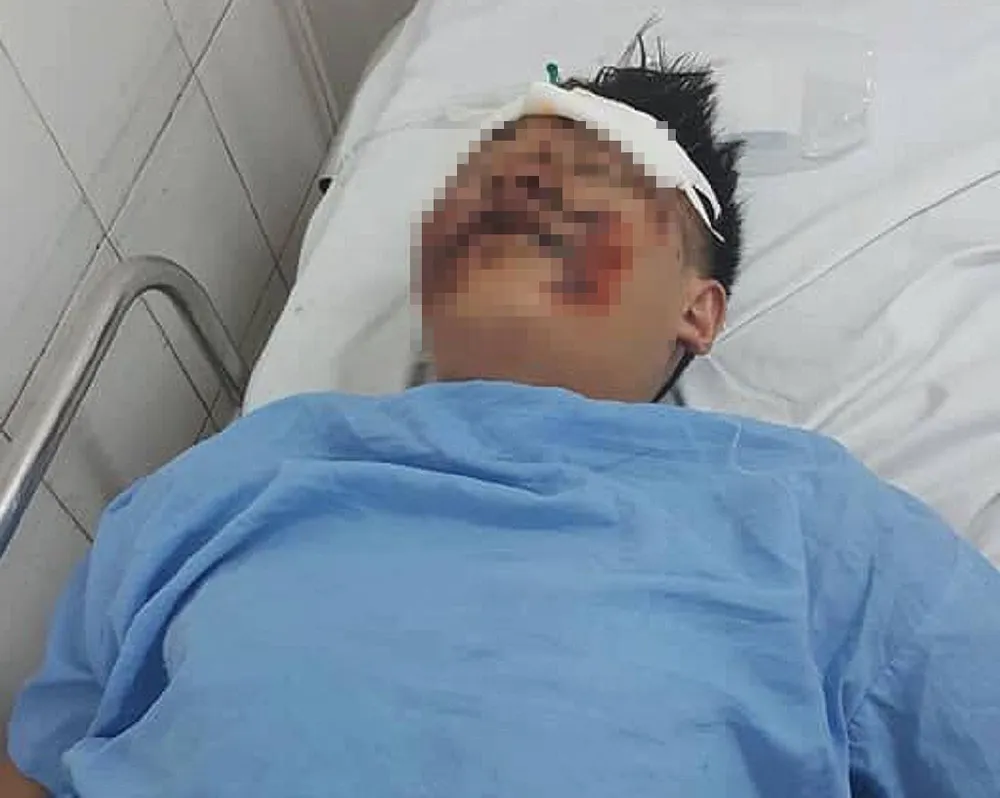 Truy tìm tài xế tông nguy kịch 2 sinh viên rồi bỏ chạy ảnh 2