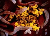 60 giờ qua, Việt Nam không có thêm ca nhiễm mới COVID-19 ảnh 1 Virus gây dịch COVID-19 sống cả giờ ở 60 độ C