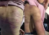 Bé gái 12 tuổi bị bạo hành, mẹ nói 'chỉ muốn dạy dỗ ngoan hơn' ảnh 4 Bé gái 12 tuổi nghi bị bạo hành, xâm hại tình dục nhiều lần