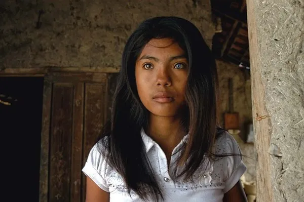 Cô gái có đôi mắt hai màu kỳ lạ ở Ninh Thuận ảnh 2