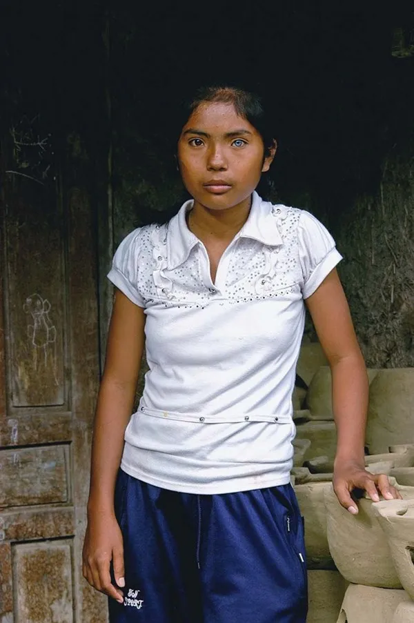 Cô gái có đôi mắt hai màu kỳ lạ ở Ninh Thuận ảnh 6