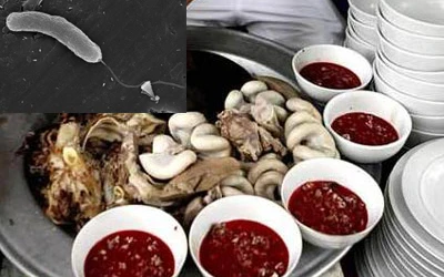 Thực phẩm “bẩn” cướp đi sinh mạng của 2 triệu người mỗi năm ảnh 1