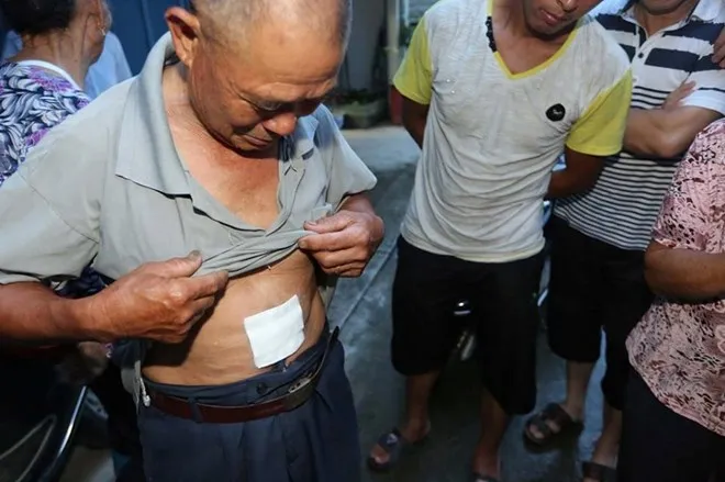 Lão nông 73 tuổi hạ gục con trăn khổng lồ chỉ bằng một tảng đá ảnh 2