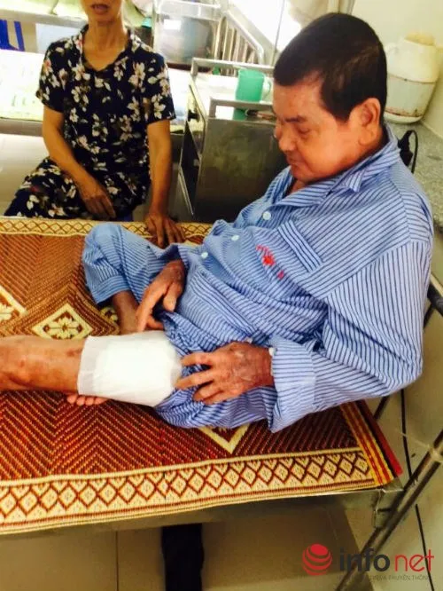 Một tuần bị nhọt, nhập viện bị cắt chân ngay lập tức ảnh 2 Một tuần bị nhọt, nhập viện bị cắt chân ngay lập tức ảnh 2