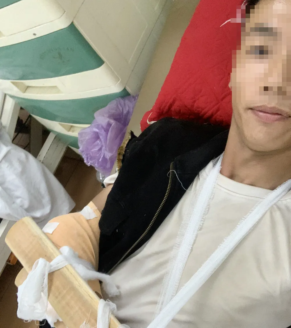 Anh D được xác định tỉ lệ thương tích là 11%. Ảnh: NVCC Anh D được xác định tỉ lệ thương tích là 11%. Ảnh: NVCC