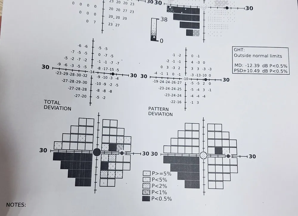 Tiêm filler thẩm mỹ
