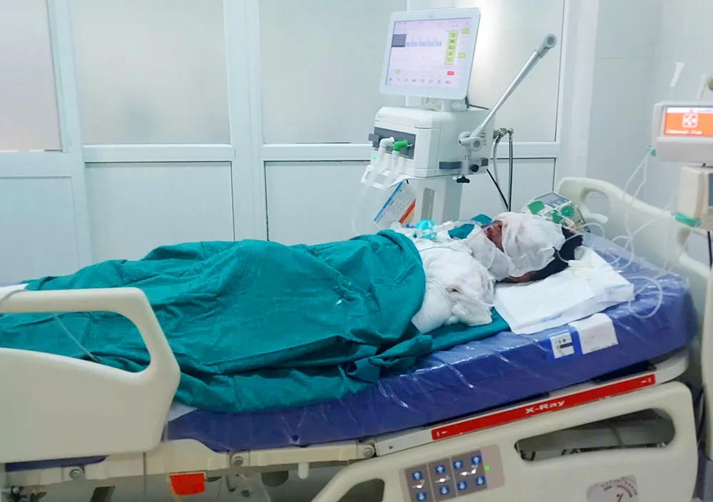 Ba người nhập viện do tự ý chế tạo pháo dẫn đến vụ nổ gây thương tích ở Kon Tum