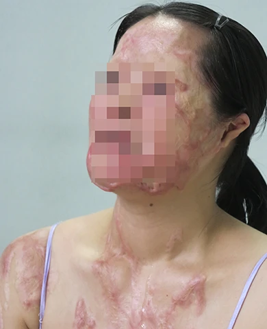 Đau thấu trời vì acid! ảnh 2