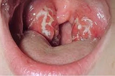 Chặn dịch bạch hầu vào TP.HCM ảnh 2