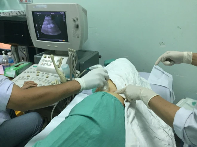 Các bác sĩ đang chọc hút dịch nang thận.