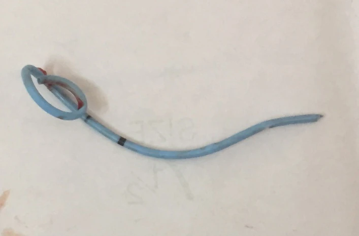 Ống thông JJ dùng dẫn lưu dịch nang thận