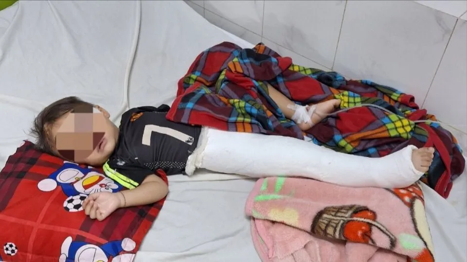cháu trai 2 tuổi gãy chân.jpg
