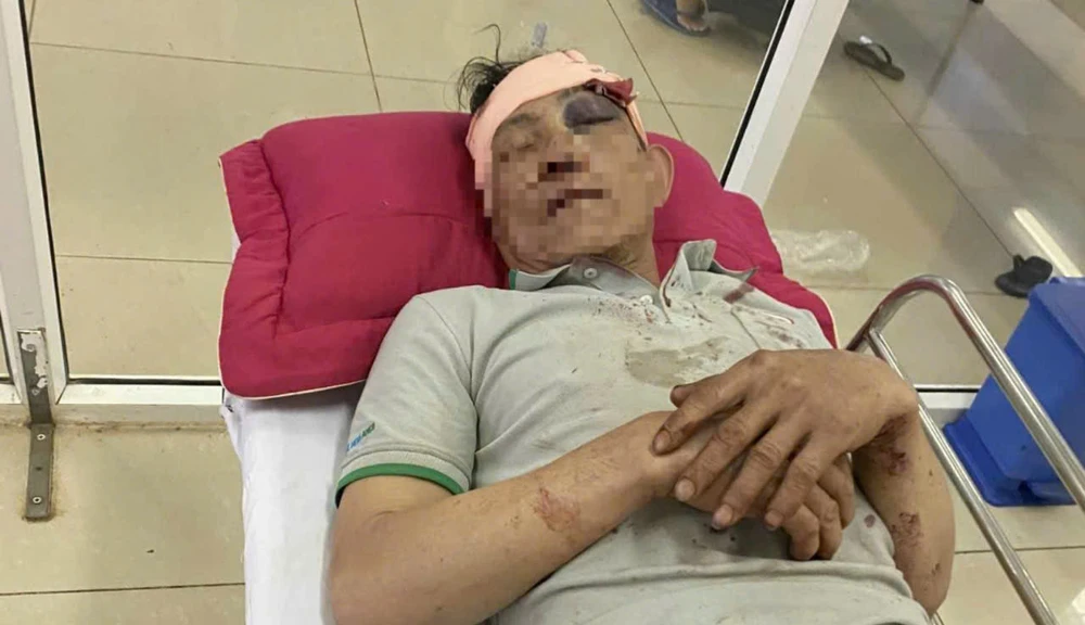 tranh chấp nguồn nước 3.jpg