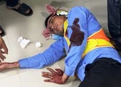 2 nhân viên trạm BOT bị đánh trọng thương khi đang làm việc