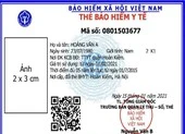 Thông tin cần biết về việc cấp thẻ bảo hiểm y tế mẫu mới ảnh 2 Từ ngày 1-4 phát hành thẻ bảo hiểm y tế mới trên toàn quốc