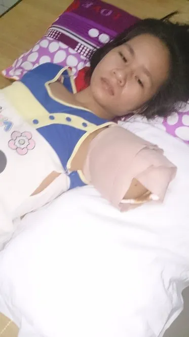 Nạn nhân Trần Thị Yến trên giường cấp cứu tại Bệnh viện chấn thương chỉnh hình Nghệ An - Ảnh: CTV