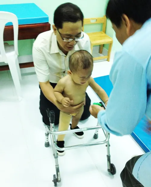 Bé văng ra khỏi bụng mẹ tập đi với chân giả ảnh 3