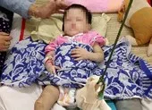 Bé gái bị mẹ nuôi đánh gãy chân: Nụ cười bé thơ và nỗi xót xa ảnh 2 Quận 9: Bé gái 1 tuổi bị mẹ nuôi đánh gãy chân
