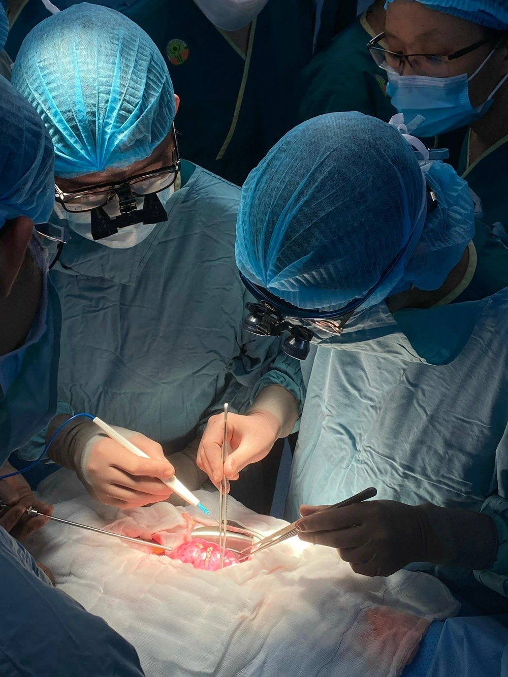 Quá trình hiến, lấy, ghép và điều trị sau ghép rất phức tạp. Ảnh: BVCC