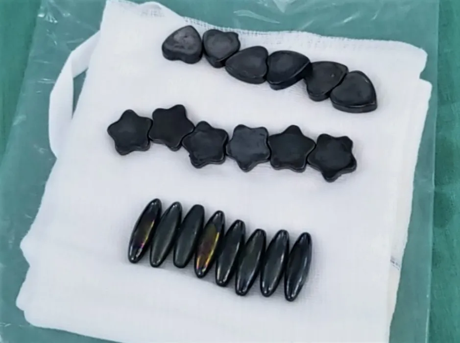 20 viên nam châm với nhiều hình thù khác nhau được lấy ra từ bụng bé trai. Ảnh: BVCC 20 viên nam châm với nhiều hình thù khác nhau được lấy ra từ bụng bé trai. Ảnh: BVCC