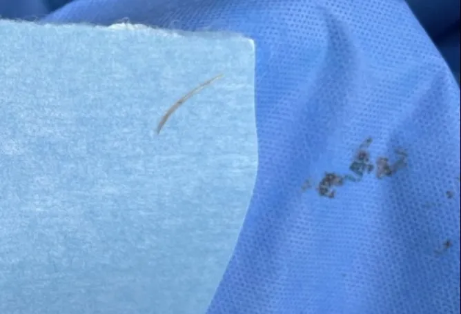 hóc xương cá - 1