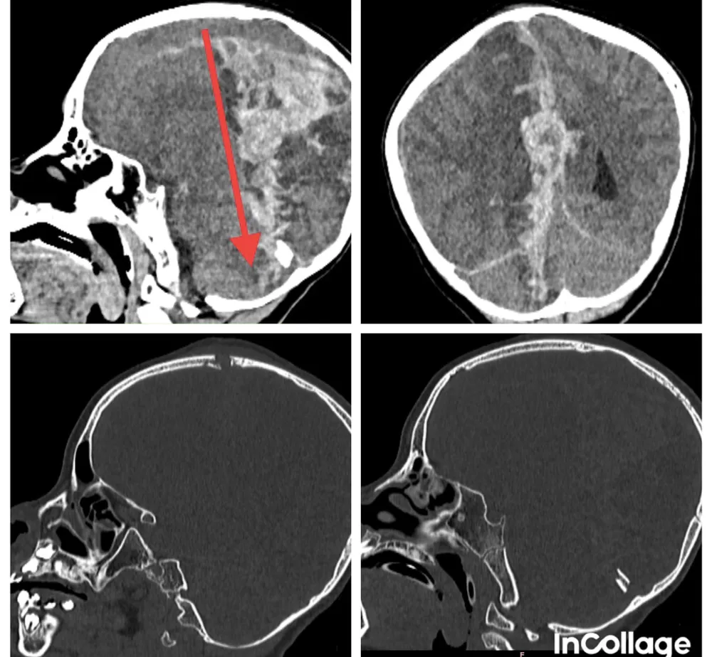 vợt cầu lông - 1