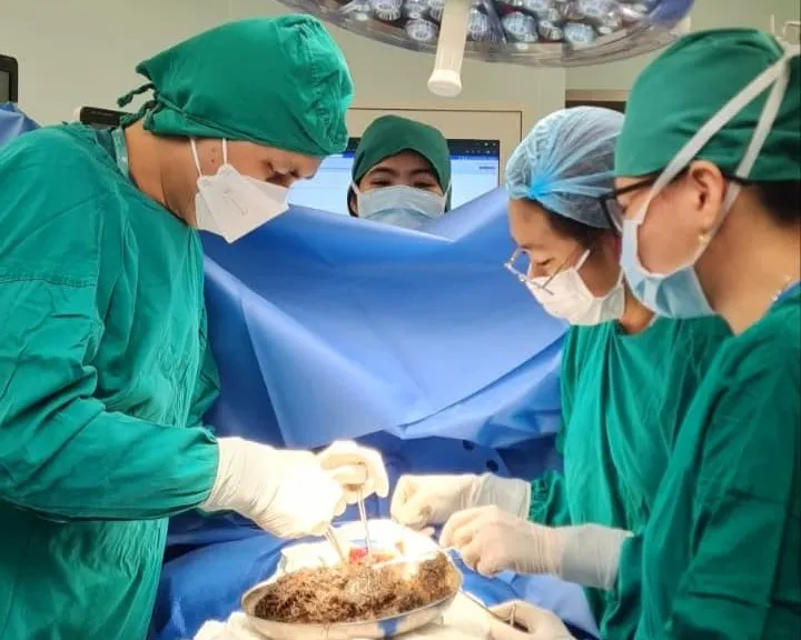 Phẫu thuật cho bé gái thủng dạ dày do thói quen nuốt tóc, rơm rạ. Ảnh: BVCC thủng dạ dày - 1