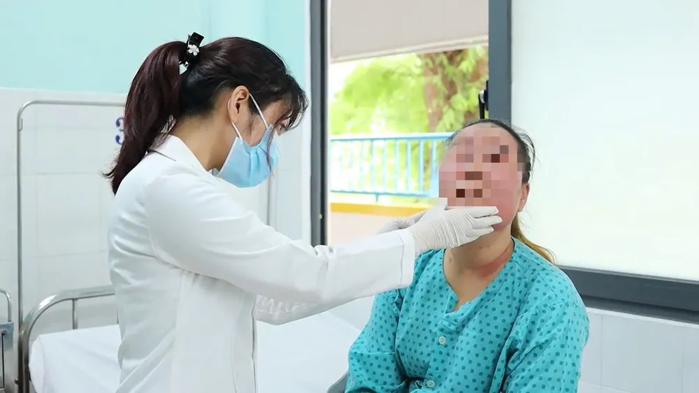Bệnh nhân L bị viêm da tiếp xúc dị ứng bội nhiễm, sưng nề sau peel da tại nhà. Ảnh: BVCC peel-da-tai-nha3.jpg