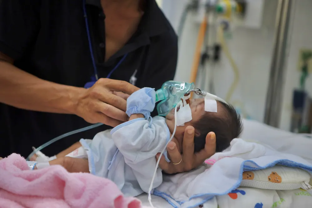 Đây là đợt tăng bệnh hô hấp do các siêu vi thông thường theo mùa hàng năm. Ảnh: NGUYỆT NHI benh-ho-hap-2.jpg