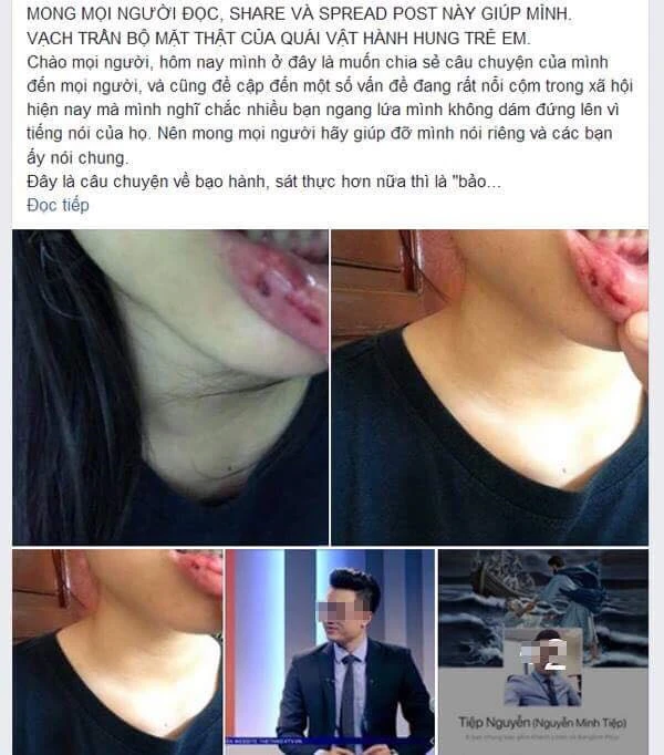 Trường Amsterdam nói về vụ nữ sinh tố bị anh rể bạo hành ảnh 1